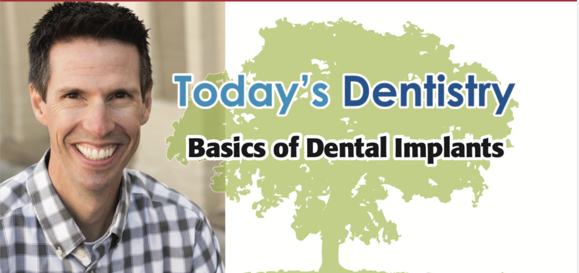 Basics of Dental Implants